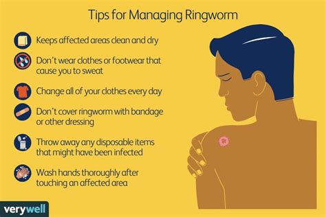 Ringworm In Babies And Children Dr Diana Du Plessis