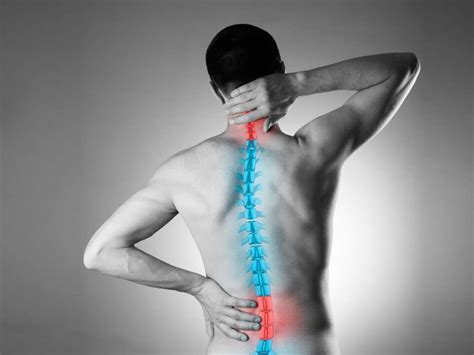 Estenosis espinal Síntoma causas y diagnóstico MS Mas Salud