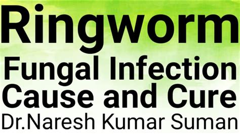 Ringworm Fungal Infection On Skin Cause Treatment And Prevention