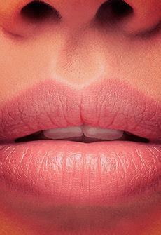 relleno de labios aumento de volumen  acido hialuronico
