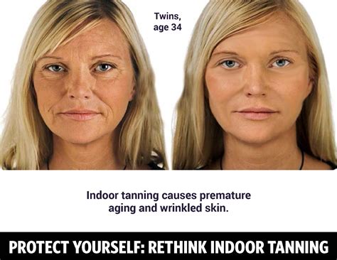 Tanning Bed Skin Damage