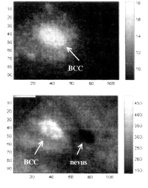 Figure 3 From Multispectral And Lifetime Imaging For The Detection Of