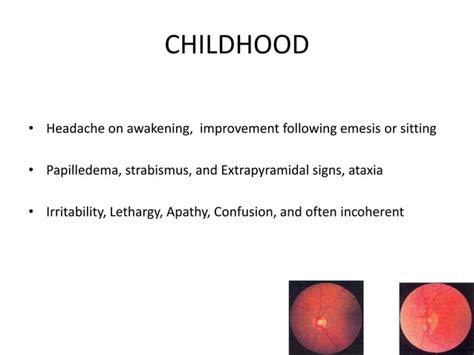 Hydrocephalus Diagnosis And Management Ppt