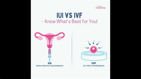 ivf vs iui know the difference youtube