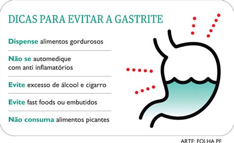 Gastrite tem cura Saiba como identificar e quais os tratamentos para a doença Vida Plena