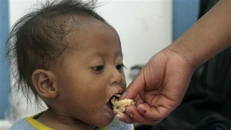 Guatemala May Declare State Of Calamity Over Malnutrition News