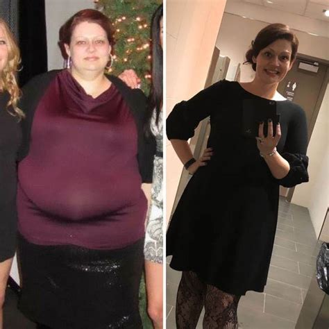 This Woman Lost 150 Pounds After Her Nutritionist Advised Her To Follow 3 Simple Rules