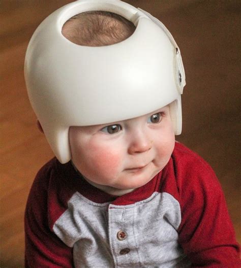 Plagiocephaly Baby Helmet At Less Cost Baby Helmet Flat Head