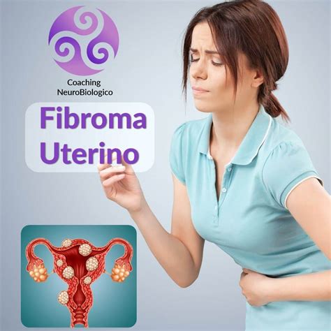 Fibroma Uterino Coaching De Salud Integral