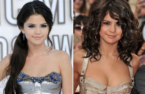 selena gomez before and after plastic surgery 03 celebrity plastic surgery online