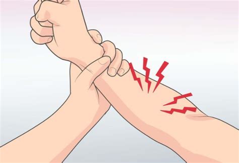 Right Arm Pain Causes
