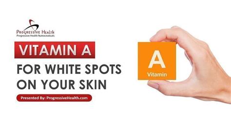 Symptoms of a vitamin b12 deficiency. Vitamin A For White Spots On Your Skin Vitamin A is one of ...