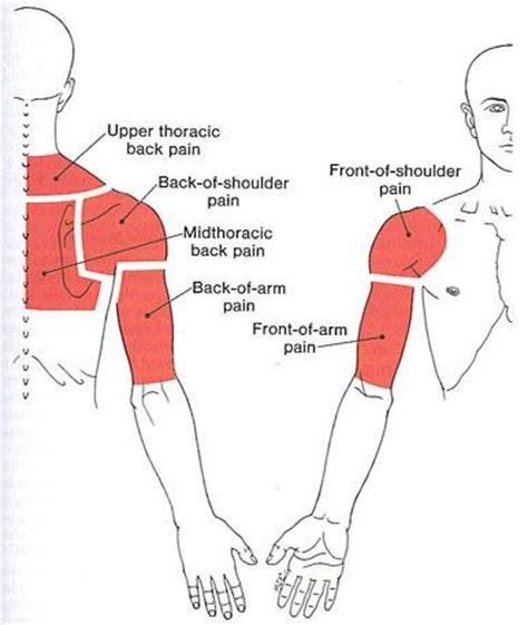 The shoulder anatomy is composed of a the shoulder blade pain will likely not happen the first time you do either of these, or even the second all of those little details are covered in this book with great diagrams and descriptions on how find and. The Trigger Point & Referred Pain Guide