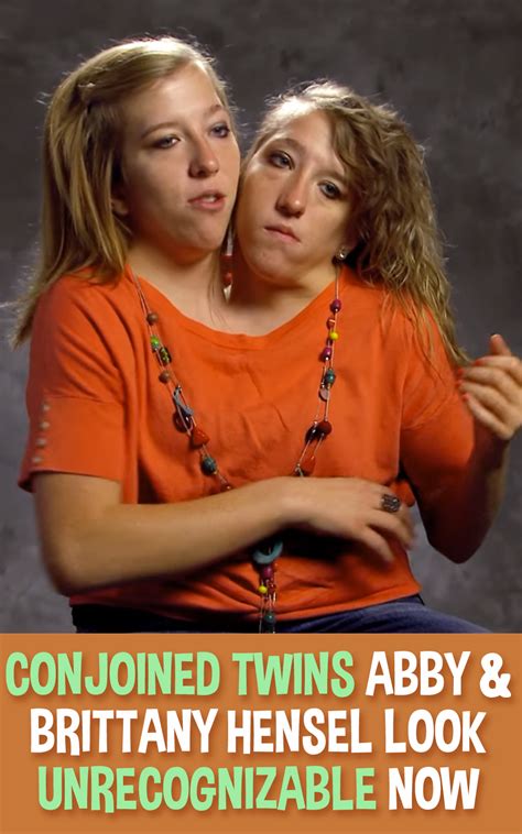 Abby And Brittany Hensel Conjoined Twins Columbusherof