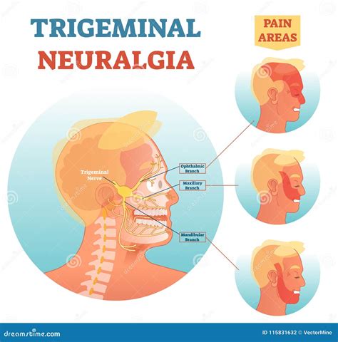 21 Anatomy Trigeminal Nerve Diagram Png