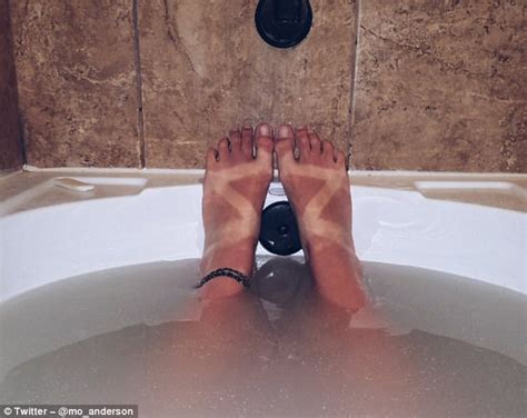 Social Media Users Share Their Terrible Tan Lines Daily Mail Online