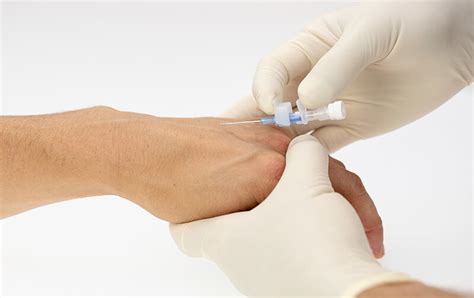 Iv Cannulation Procedure For Nurses How To Place A Peripheral Iv