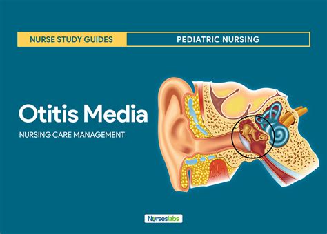 Otitis Media Nursing Diagnosis And Intervention