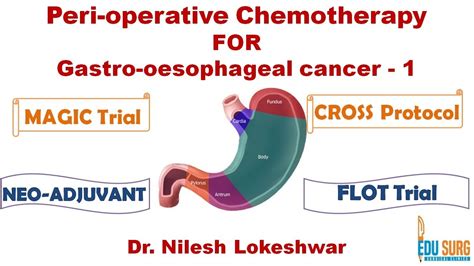 Chemotherapy In Gastric Cancer And Esophageal Cancer Basis Magic Trial