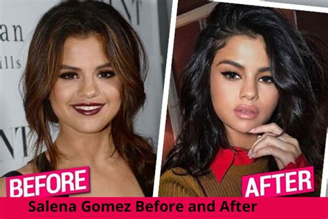 before and after selena gomez did selena gomez ever get plastic surgery
