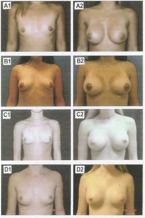 Perfect Tits Size - Nude Breasts Size Comparison CLOUDY GIRL PICS. 