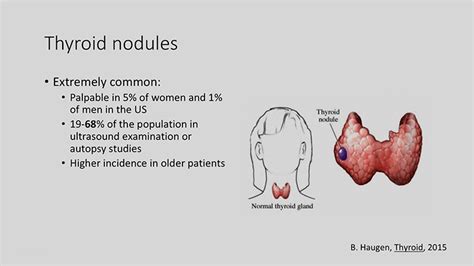 Video Thyroid Nodules Cancer Risk Factors And Radiation Exposure