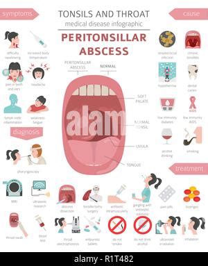 Tonsils And Throat Diseases Peritonsillar Abscess Symptoms Treatment Icon Set Medical