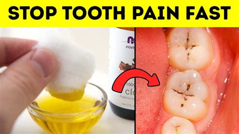 How To Stop Tooth Pain Fast In A Minute Natural Tooth Pain Home