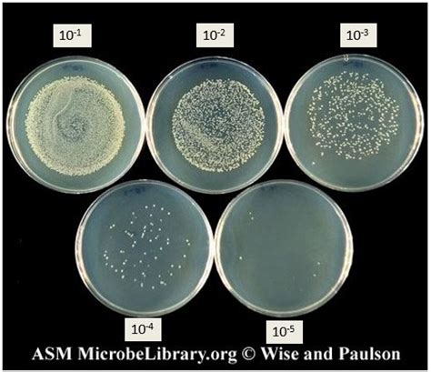 Bacterial Culture Plates