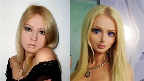 Así se veía la Barbie Humana antes de sus operaciones