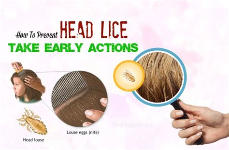 Top 14 Tips On How To Prevent Head Lice In Children And Adults Naturally