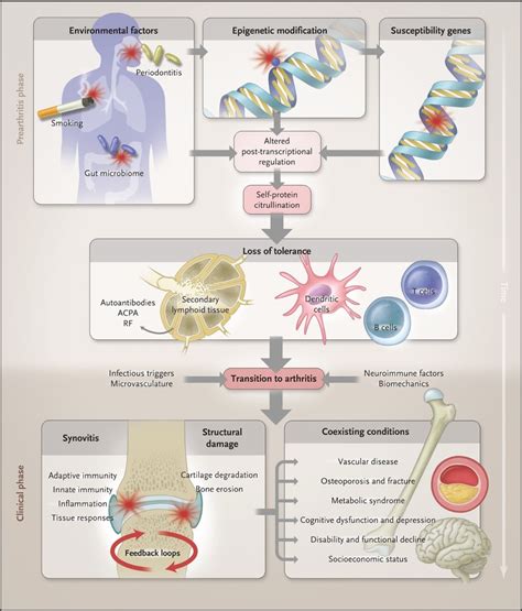 Pathogenesis Of Rheumatoid Arthritis Novel Drug Delivery Systems For