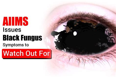 Aiims Issues Black Fungus Symptoms To Watch Out For Check Full