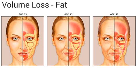 Ageing Of The Face Faciem Dermatology Clinic