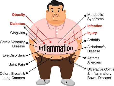 Chronic Inflammation Disease Begins In Your Gut