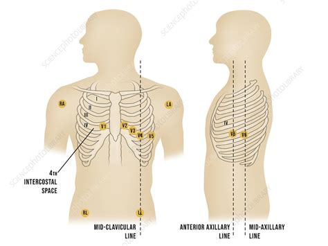 Placement Of Ecg Electrodes Illustration Stock Image