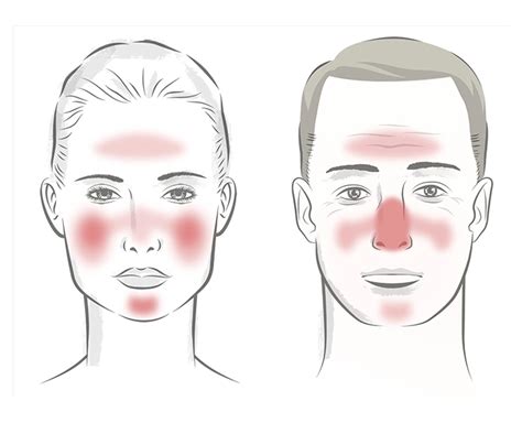 5 Common Adult Skin Rashes Suncoast Skin