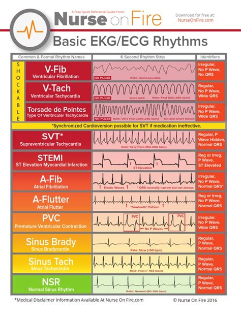 Cheat Sheet Ekg Strips Examples Basic Ekg Ecg Rhythms Cheatsheet