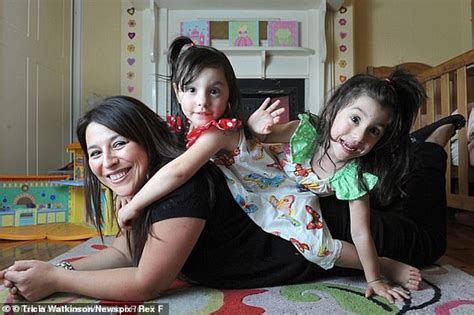 The Premature Twins Born 16 Days Apart Three Year Old Sisters Alessia And Lara Stunned Doctors