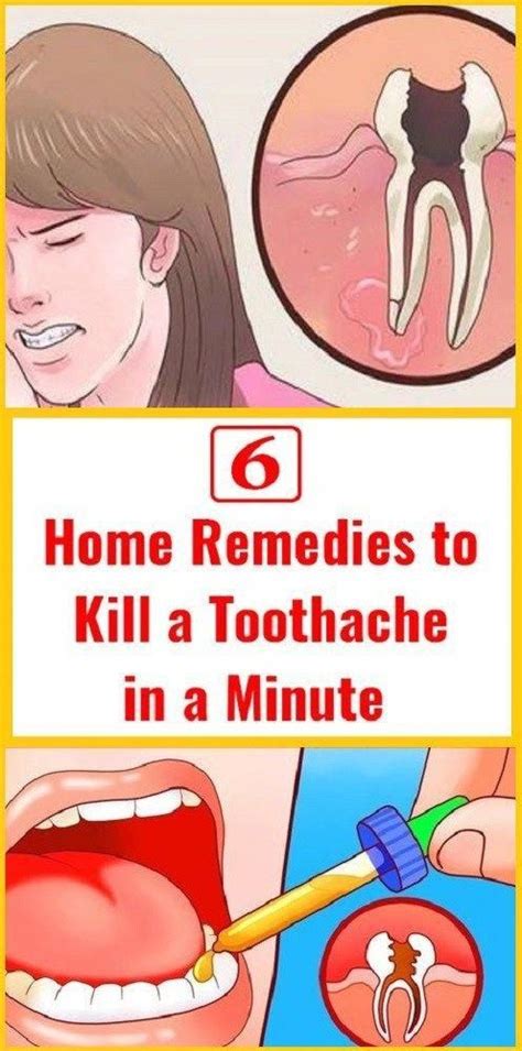 How is wisdom tooth extraction done? Pin on Remedies for tooth ache