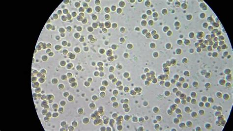 Healthy Human Blood Red Blood Cells Under Microscope Magnification
