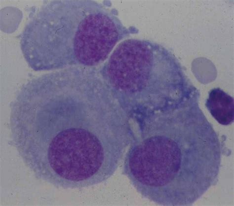 Mesothelial Cells With Window And Microvilli Hematology Medical