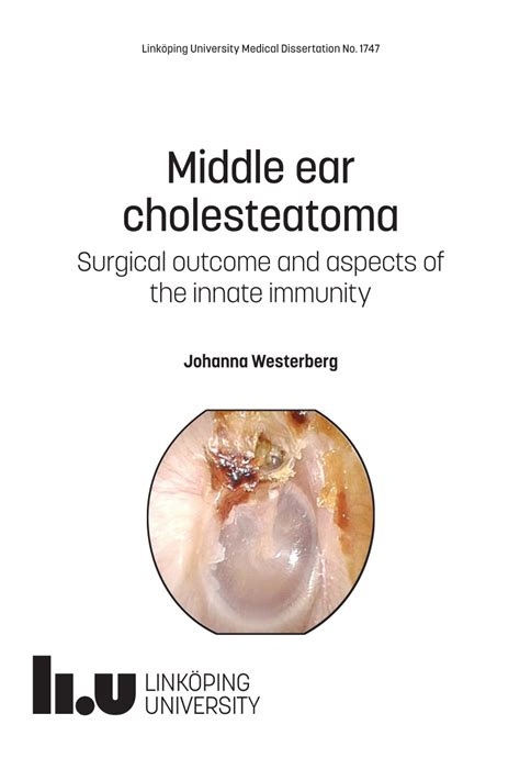 Pdf Middle Ear Cholesteatoma Surgical Outcome And Aspects Of The