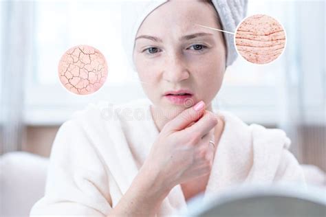 Young Woman Looking At Dry Skin With Cracks And With Wrinkles Circles