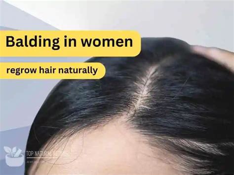 How To Regrow Thinning Hair Female In 3 Weeks Top Natural Recipes