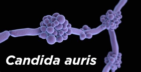 Candida Auris—a New Threat To Patients Apic