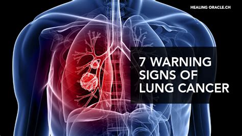 Can Lung Cancer Change Your Personality 5 Symptoms And Warning Signs