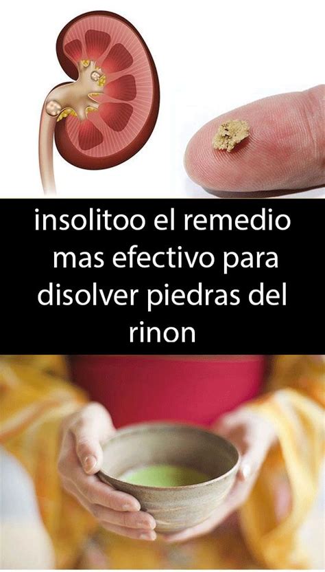 Insolitoo El Remedio Mas Efectivo Para Disolver Piedras Del Rinon