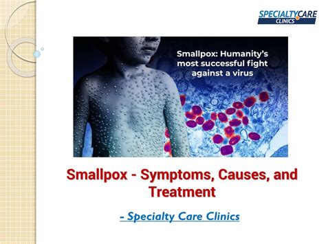 Ppt Smallpox Symptoms Causes And Treatment Powerpoint