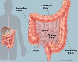 Kristen ciombor, a medical oncologist and assistant professor of internal medicine for the ohio state. How Do You Know If You Have Colon Cancer?
